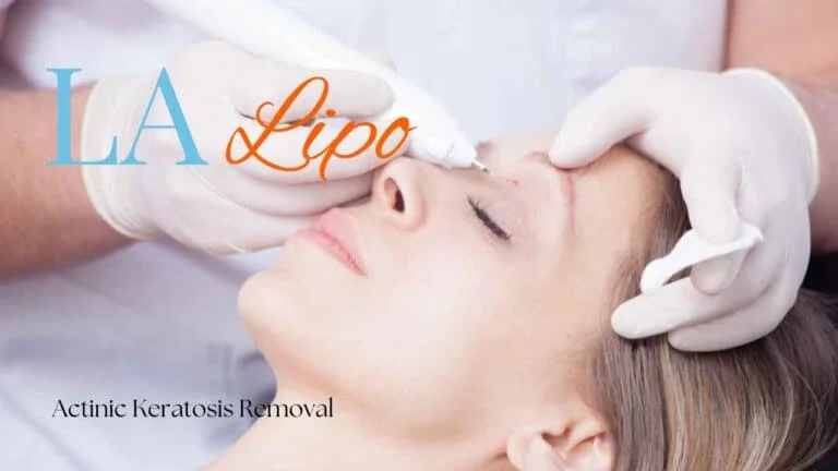 Woman receiving Actinic Keratosis Removal Treatment Kentish Town