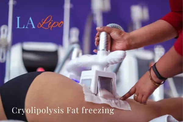 women getting fat freezing Kentish Town