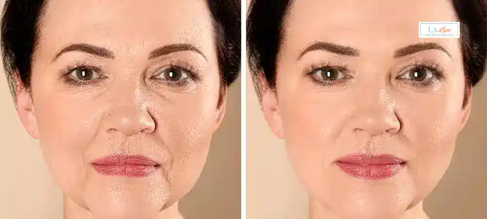 Why Aren’t My Skincare Products Making My Sagging Skin Look Firmer Kentish Town?